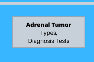 adrenal tumor - tests - image