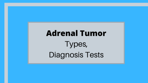 adrenal tumor - tests - image