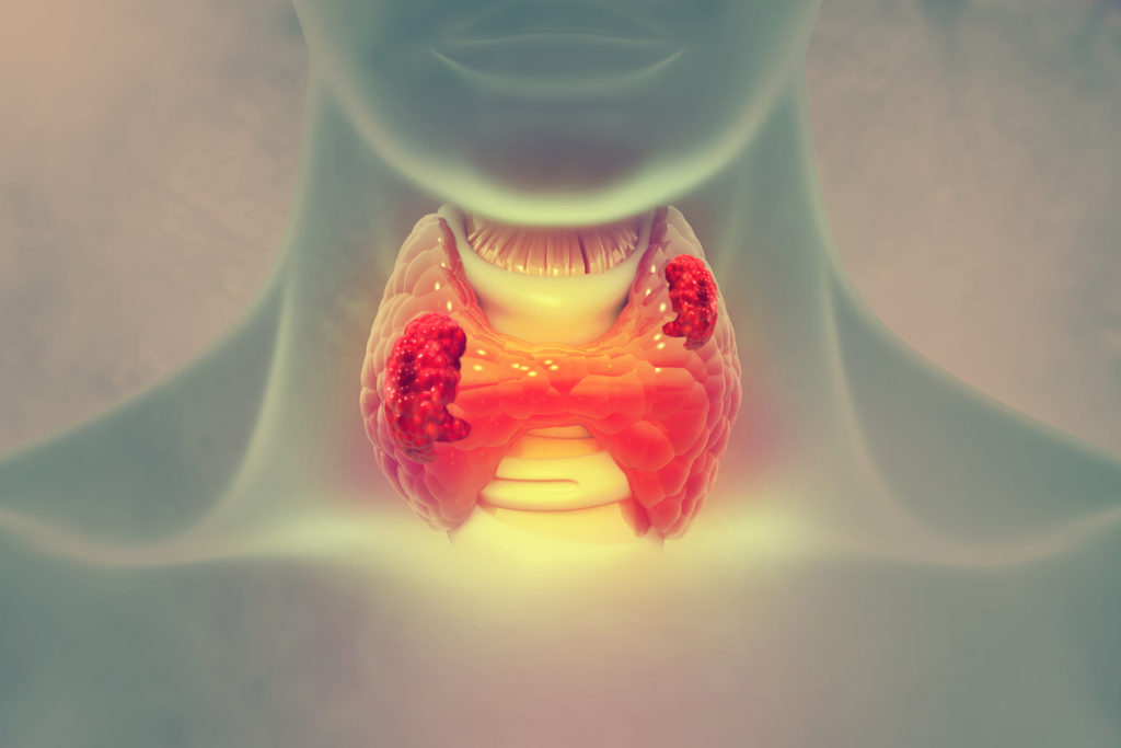 toxic-multinodular-goiter-and-solitary-toxic-adenoma-radiology-key