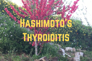 Hashimoto's Thyroiditis , myths, diagnosis, treatment